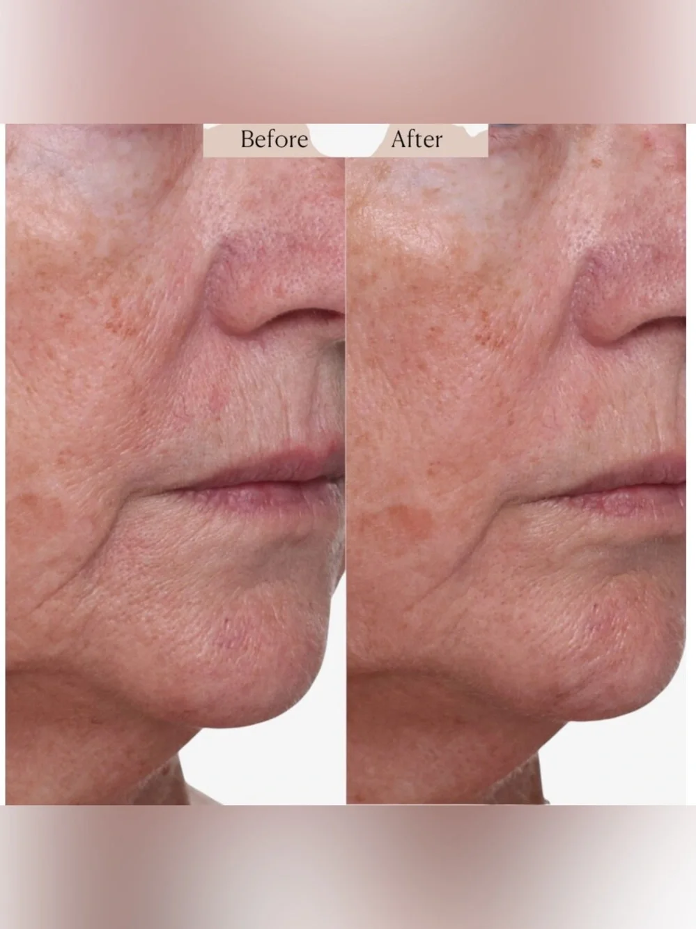 Nakery Beauty SkinRepair Retinol Deep Wrinkle Serum- firming, lifting, smoothing